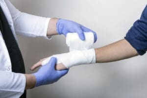 How to File a Claim for a Burn Injury at the Workplace