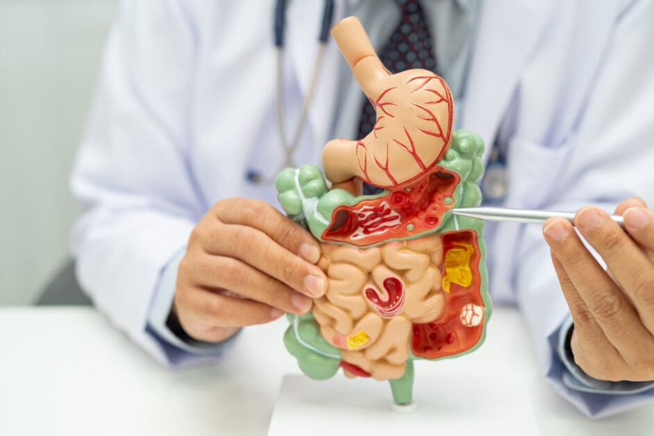 - Attorneys.Media - Legal Expert Interviews & Trusted Advice Medical Professional Holding and Pointing at a Detailed Plastic Digestive System Model Showing Stomach and Intestines, with a Stethoscope Nearby.